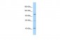 Hdac4 Antibody - C-terminal region